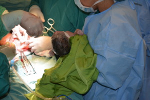 Nacimiento de sextillizos en hospital Reynaldo Almánzar.