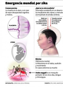 caso de microcefalia 1